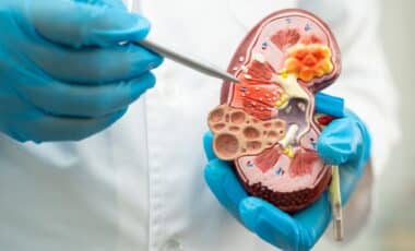 Turmeric's Surprising Effects What It Could Do To Your Kidneys